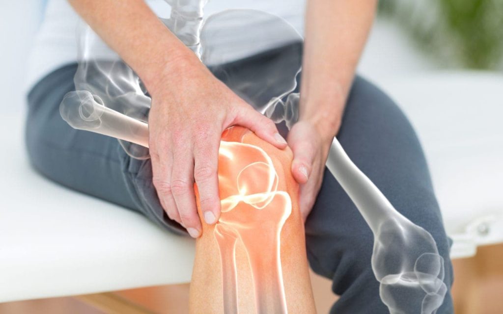 Artrite (reumatoide, artrosi e gotta): sintomi e rimedi